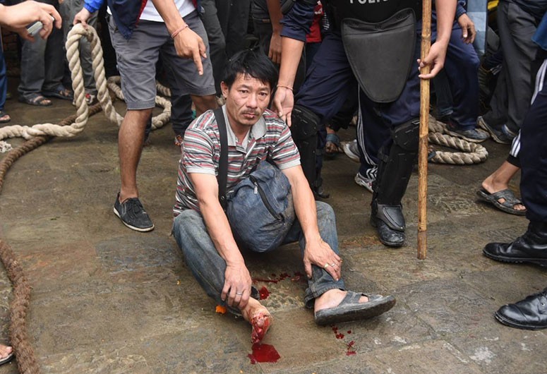 लामो लिङ्गोले ३ जनालाइ घायल बनायो